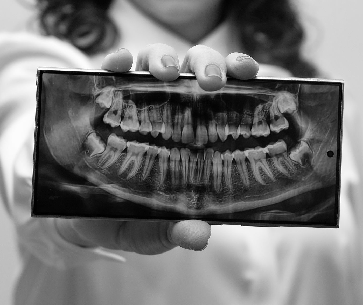 Crowning Glory: A Guide to Dental Crowns — Dentacare dental guidance