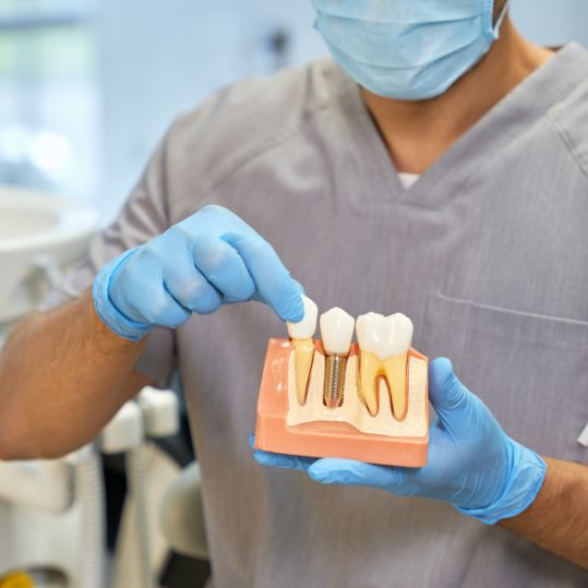 Dental Implants Services | Best Dental Implants in Bilekahalli | Denta Care