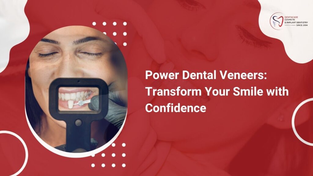 Dental Veneers Service in Bannerghatta Road | Denta Care