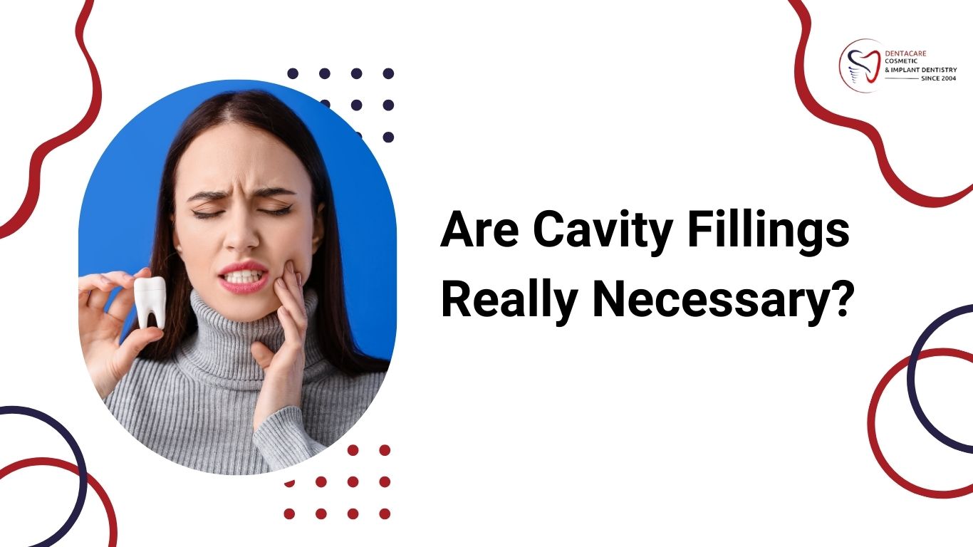 Cavity Treatment in Bannerghatta Road